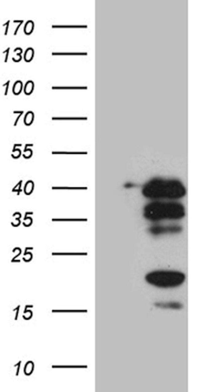 CREM Antibody in Western Blot (WB)