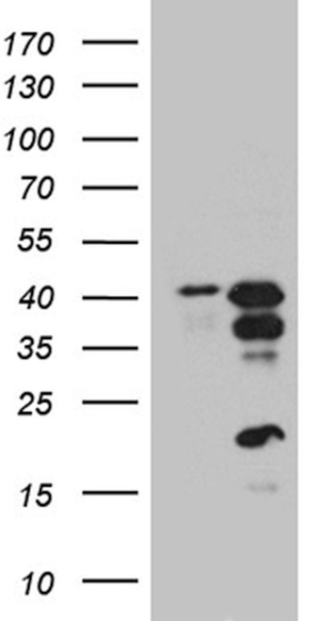 CREM Antibody in Western Blot (WB)