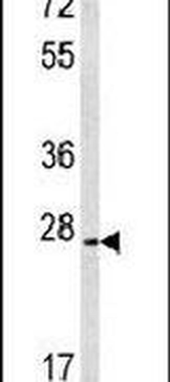 CREM Antibody in Western Blot (WB)