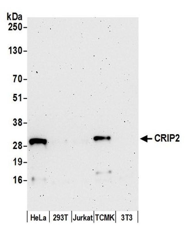 CRIP2 Antibody in Western Blot (WB)