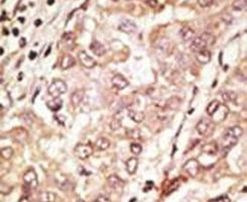 Cripto Antibody in Immunohistochemistry (IHC)
