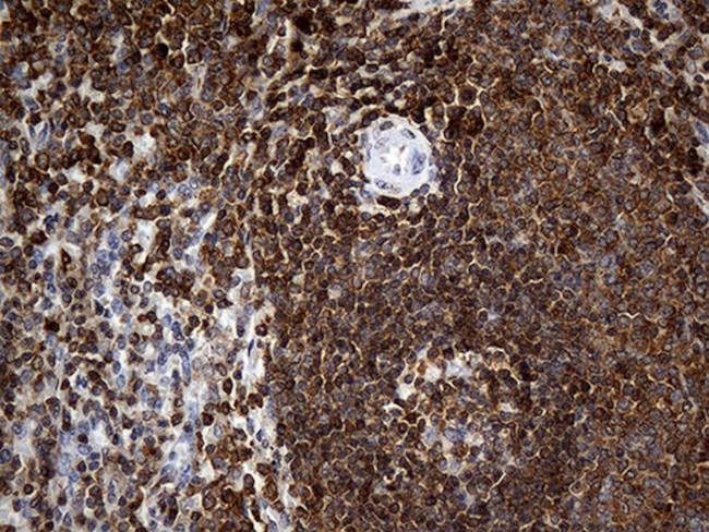CRLF3 Antibody in Immunohistochemistry (Paraffin) (IHC (P))