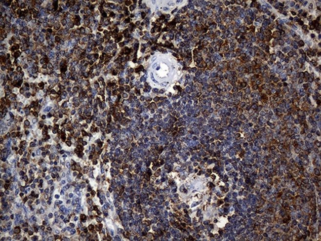CRLF3 Antibody in Immunohistochemistry (Paraffin) (IHC (P))