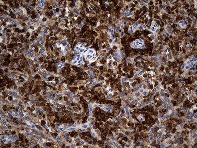 CRLF3 Antibody in Immunohistochemistry (Paraffin) (IHC (P))