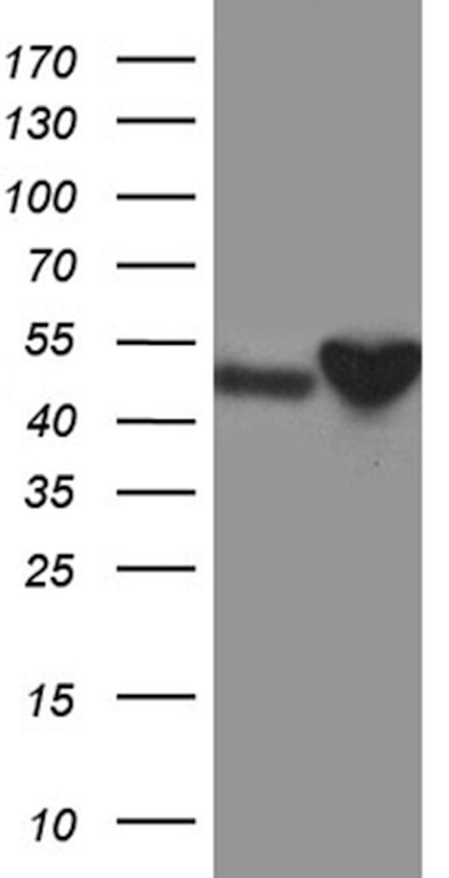 CRLF3 Antibody in Western Blot (WB)