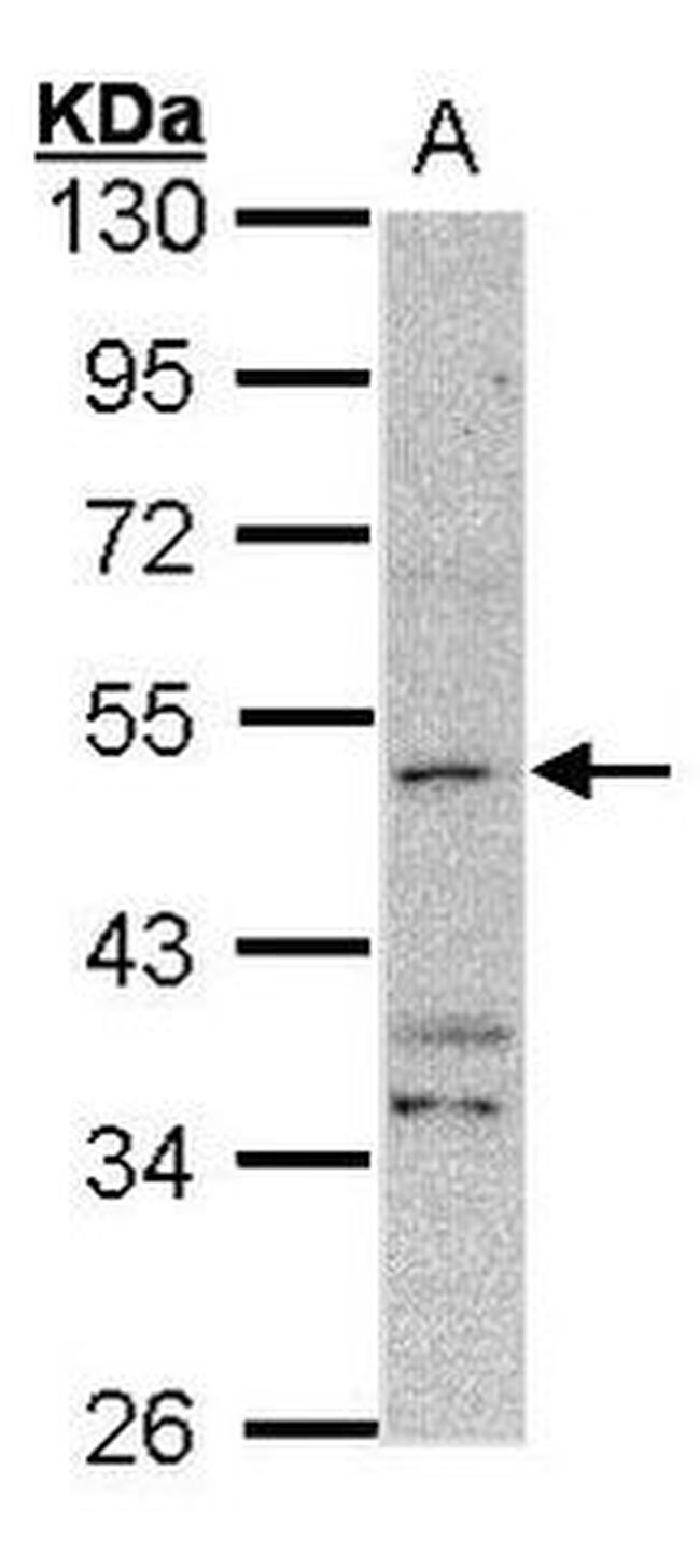 CALCRL Antibody in Western Blot (WB)