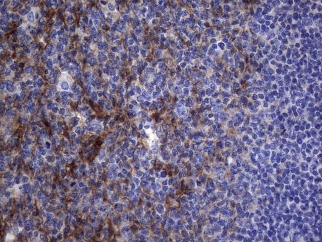 CRP Antibody in Immunohistochemistry (Paraffin) (IHC (P))