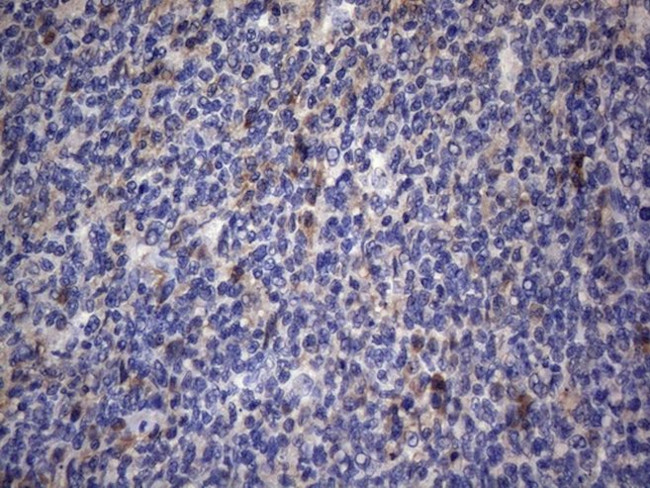 CRP Antibody in Immunohistochemistry (Paraffin) (IHC (P))
