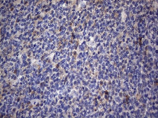 CRP Antibody in Immunohistochemistry (Paraffin) (IHC (P))