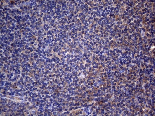 CRP Antibody in Immunohistochemistry (Paraffin) (IHC (P))