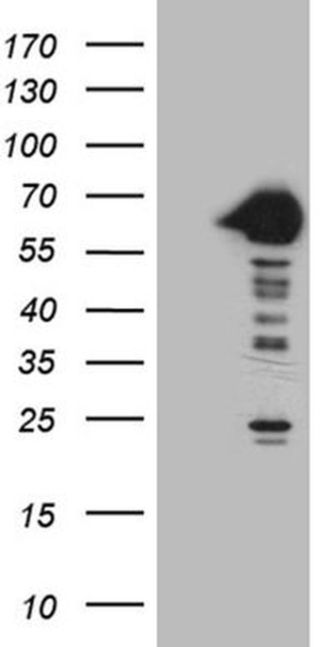 CRY1 Antibody in Western Blot (WB)