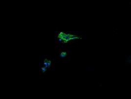 CRYAA Antibody in Immunocytochemistry (ICC/IF)