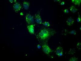 CRYAB Antibody in Immunocytochemistry (ICC/IF)