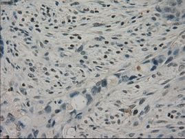 CRYAB Antibody in Immunohistochemistry (Paraffin) (IHC (P))