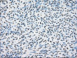 CRYAB Antibody in Immunohistochemistry (Paraffin) (IHC (P))