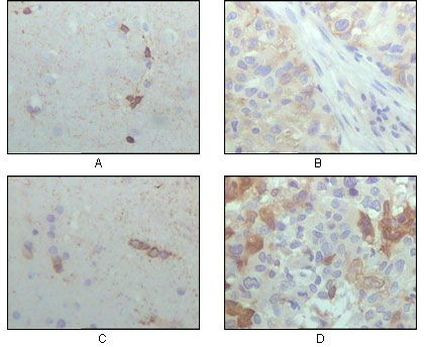 CRYAB Antibody in Immunohistochemistry (Paraffin) (IHC (P))