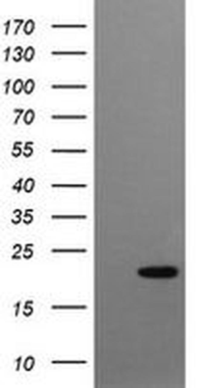 CRYGC Antibody in Western Blot (WB)
