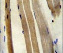 Citrate Synthase Antibody in Immunohistochemistry (IHC)