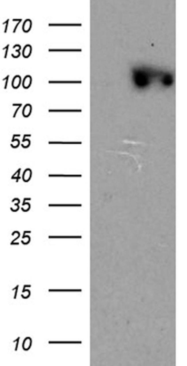 CSE1L Antibody in Western Blot (WB)