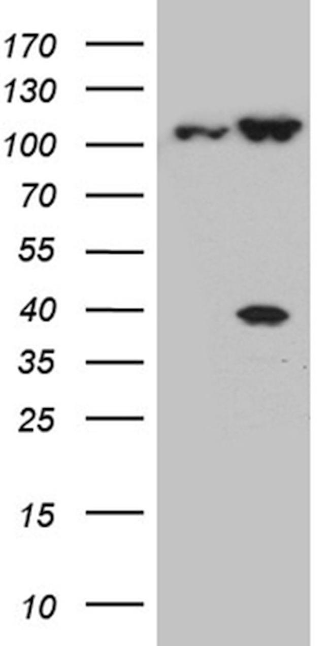 CSE1L Antibody in Western Blot (WB)