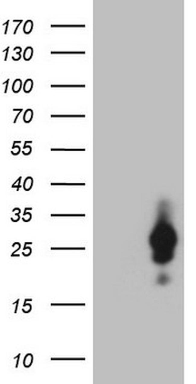 CSF2 Antibody in Western Blot (WB)