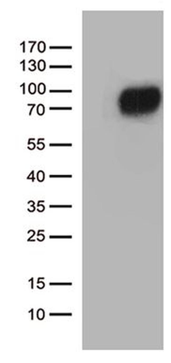 CSF2RA Antibody in Western Blot (WB)