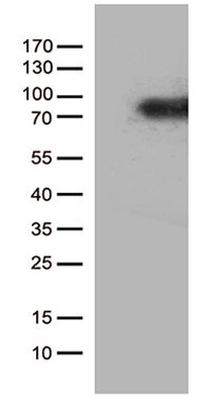 CSF2RA Antibody in Western Blot (WB)