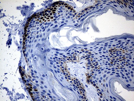 CSF3 Antibody in Immunohistochemistry (Paraffin) (IHC (P))