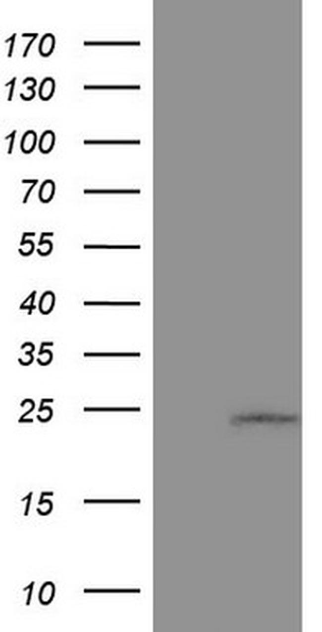 CSF3 Antibody in Western Blot (WB)