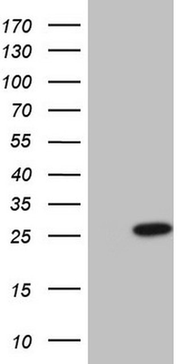 CSF3 Antibody in Western Blot (WB)