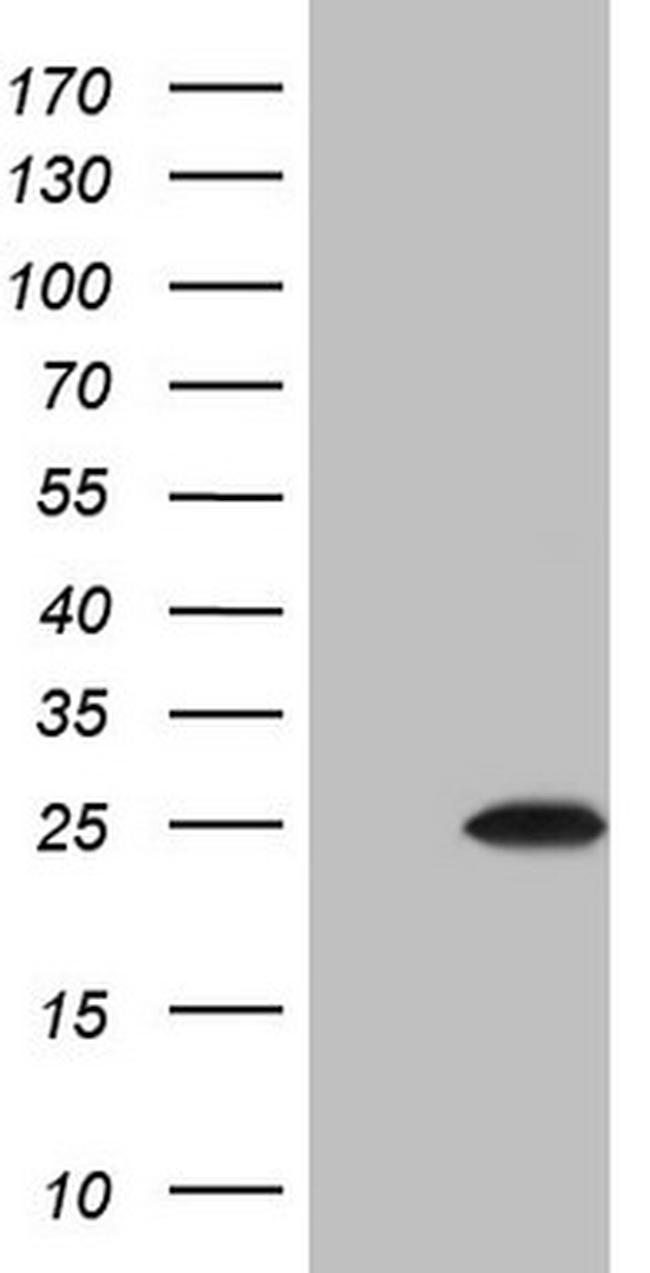 CSF3 Antibody in Western Blot (WB)