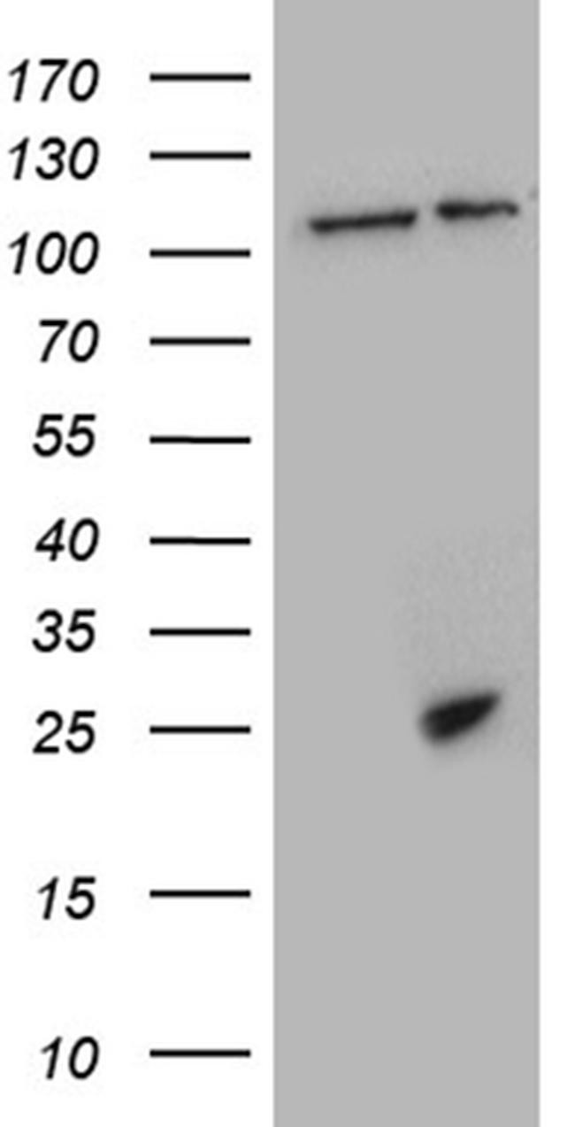 CSF3 Antibody in Western Blot (WB)