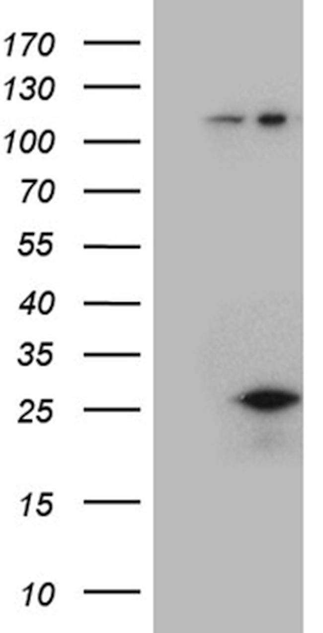 CSF3 Antibody in Western Blot (WB)