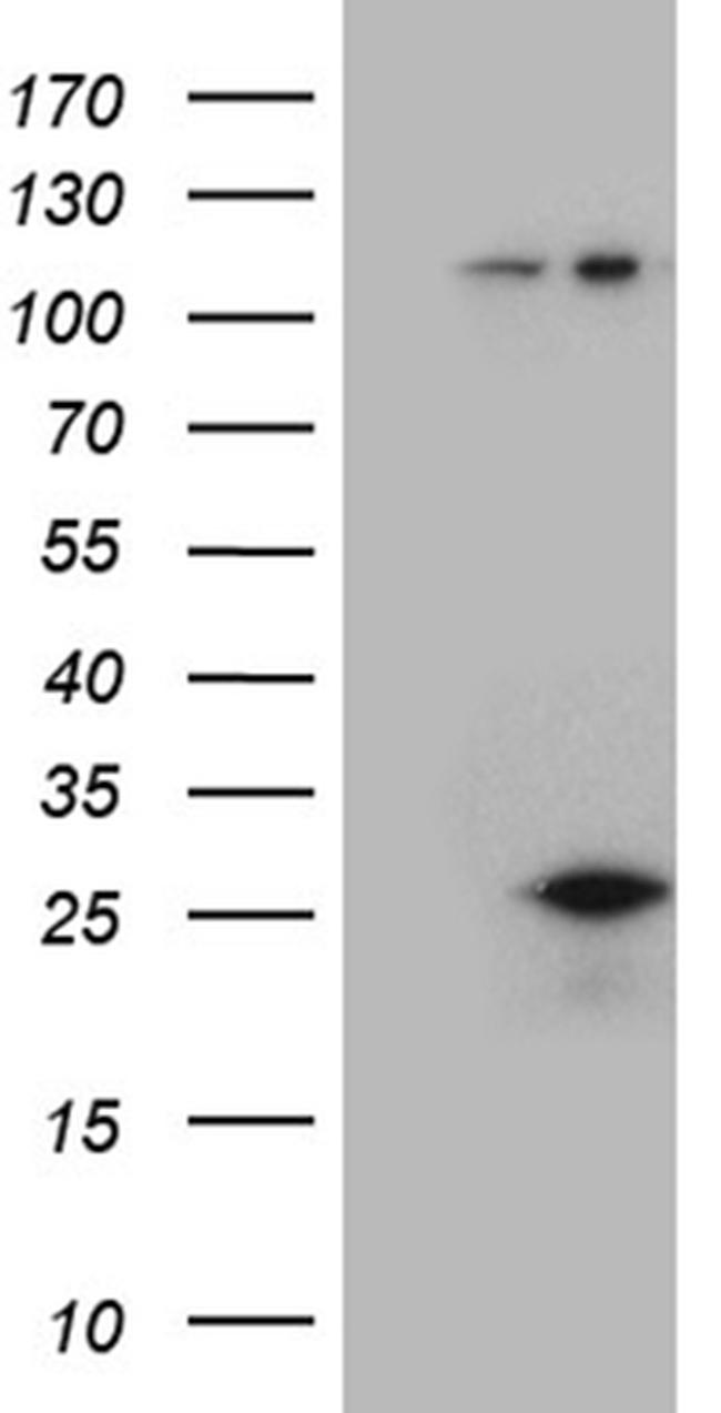 CSF3 Antibody in Western Blot (WB)