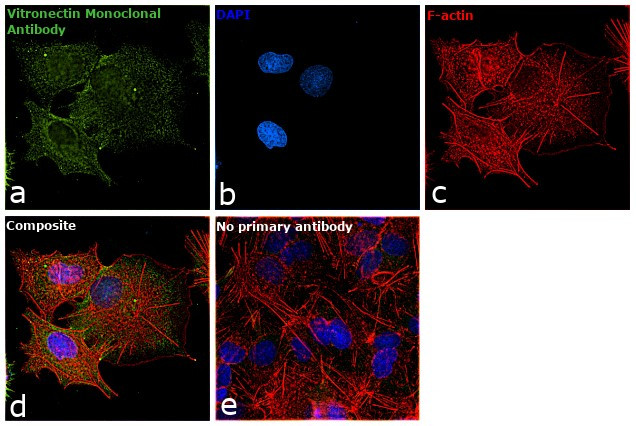 Vitronectin Monoclonal Antibody (HV2) | Invitrogen (CSI 003-02-02)