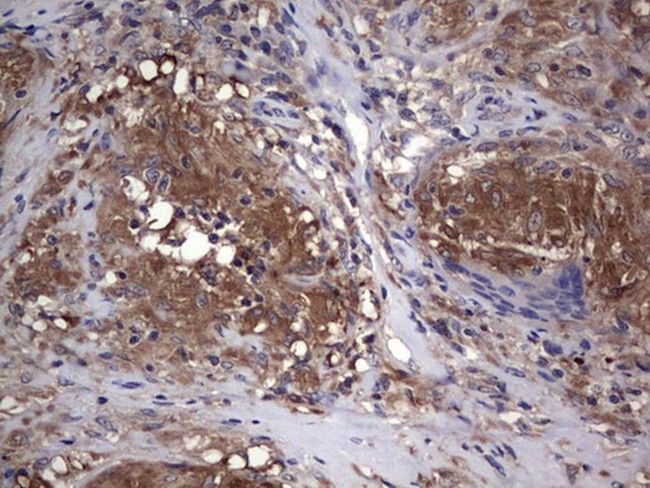 CSNK1E Antibody in Immunohistochemistry (Paraffin) (IHC (P))