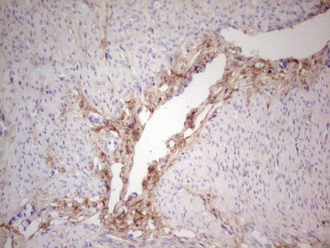 CSNK1G1 Antibody in Immunohistochemistry (Paraffin) (IHC (P))