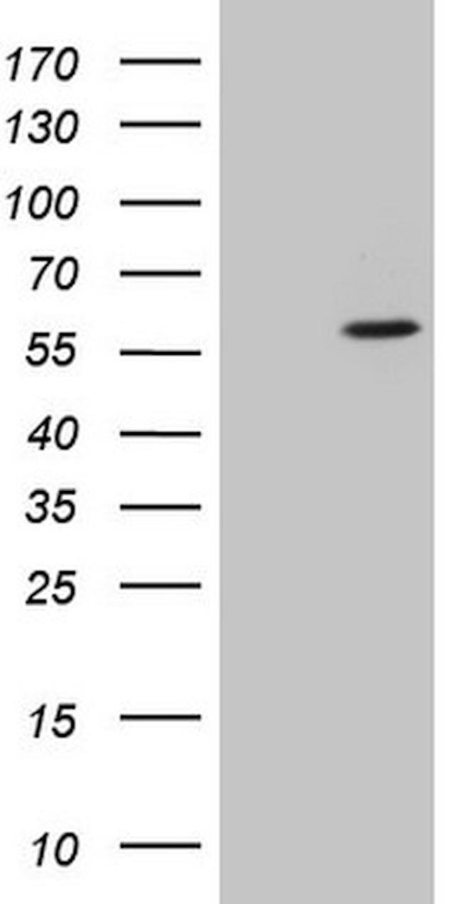 CSNK1G1 Antibody in Western Blot (WB)