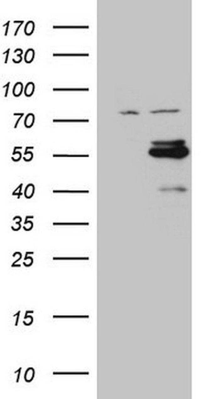 CSNK1G1 Antibody in Western Blot (WB)