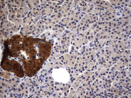 CSNK1G2 Antibody in Immunohistochemistry (Paraffin) (IHC (P))
