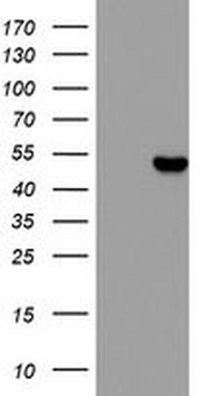 CSNK1G2 Antibody in Western Blot (WB)