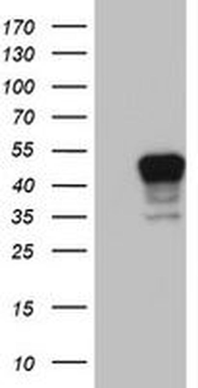 CSNK1G2 Antibody in Western Blot (WB)