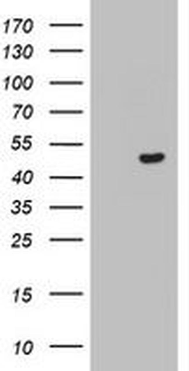 CSNK1G2 Antibody in Western Blot (WB)