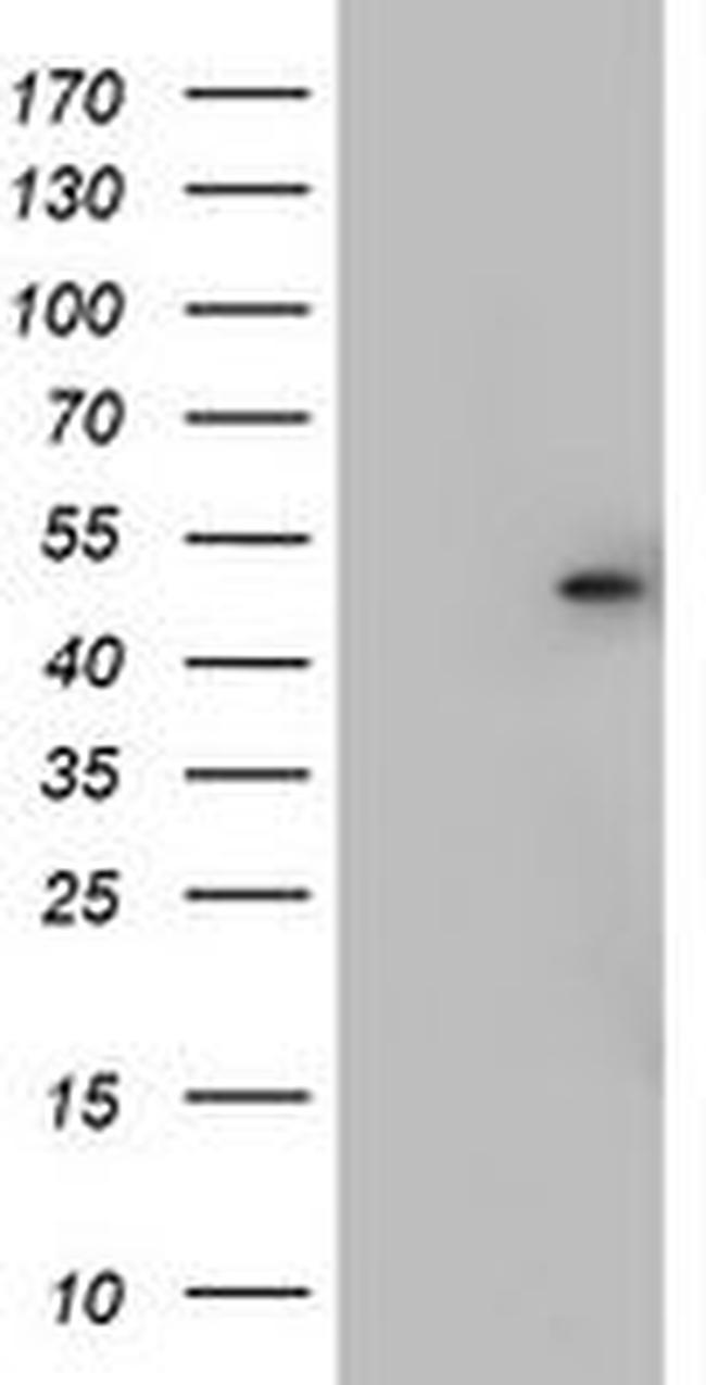 CSNK1G2 Antibody in Western Blot (WB)