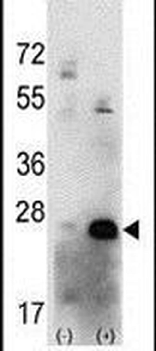 CK2 beta Antibody in Western Blot (WB)