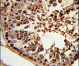 CSPP1 Antibody in Immunohistochemistry (IHC)