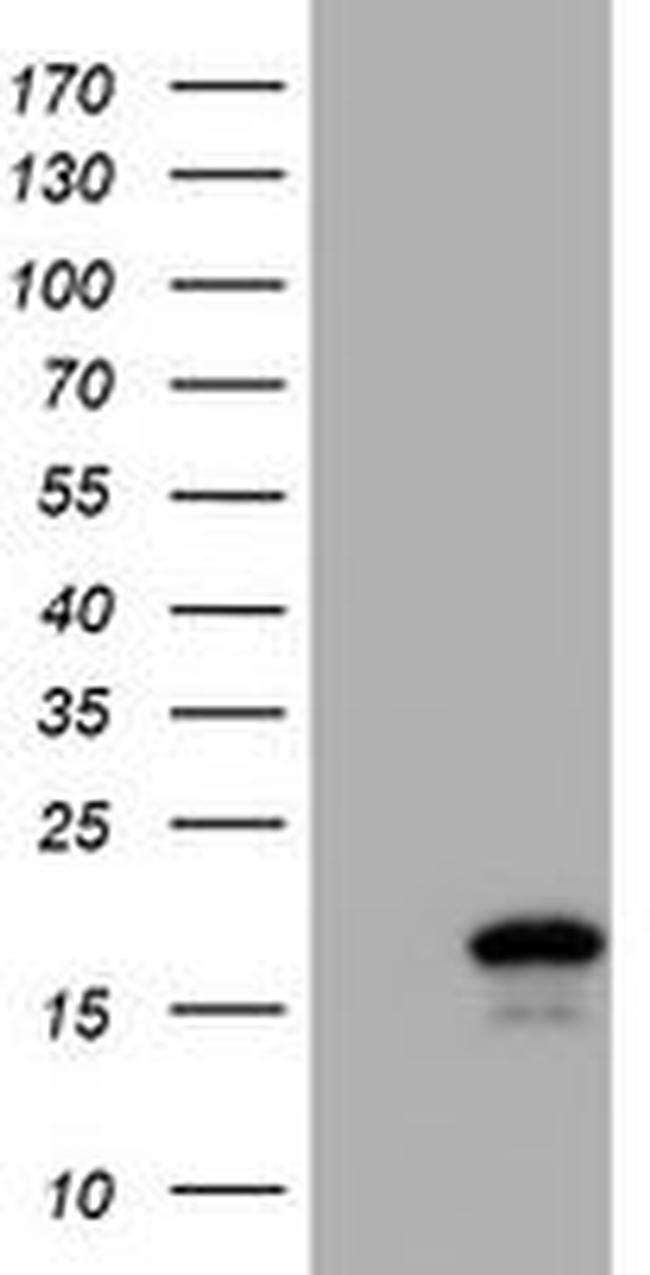 CST2 Antibody in Western Blot (WB)