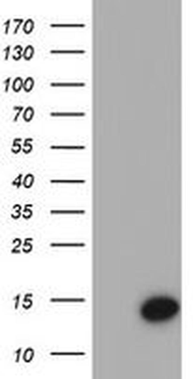 CST4 Antibody in Western Blot (WB)