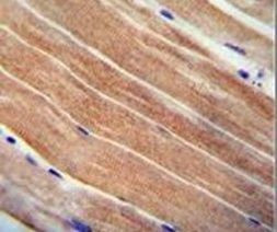 Cystatin 9 Antibody in Immunohistochemistry (IHC)
