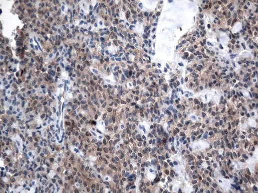 CSTB Antibody in Immunohistochemistry (Paraffin) (IHC (P))